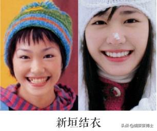 日本整容失败面目全非的10大女星,日本整容最成功的女星