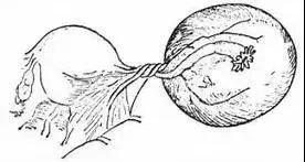 什么妇科炎症会引起女性腰骶疼痛,女性小腹疼痛要警惕四种病