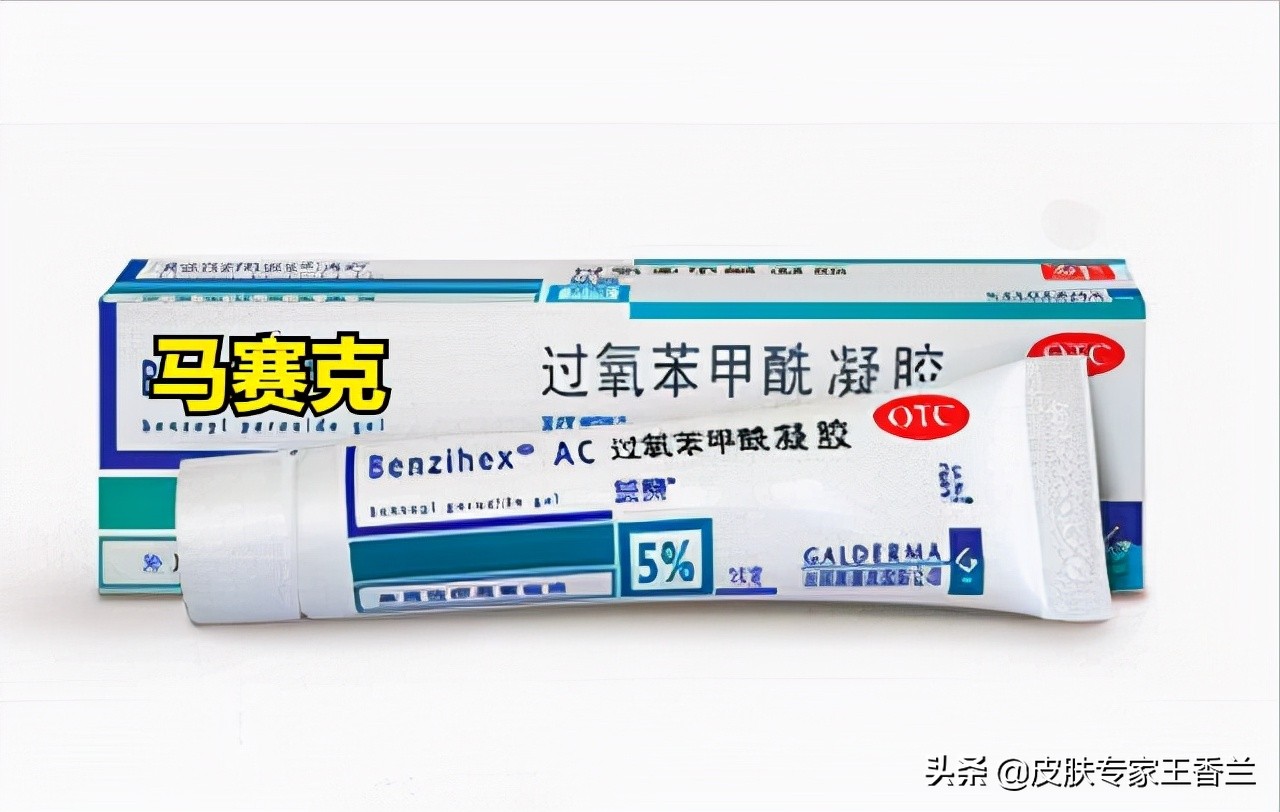 皮肤科医生推荐的祛痘药膏,皮肤科医生推荐的祛痘精华