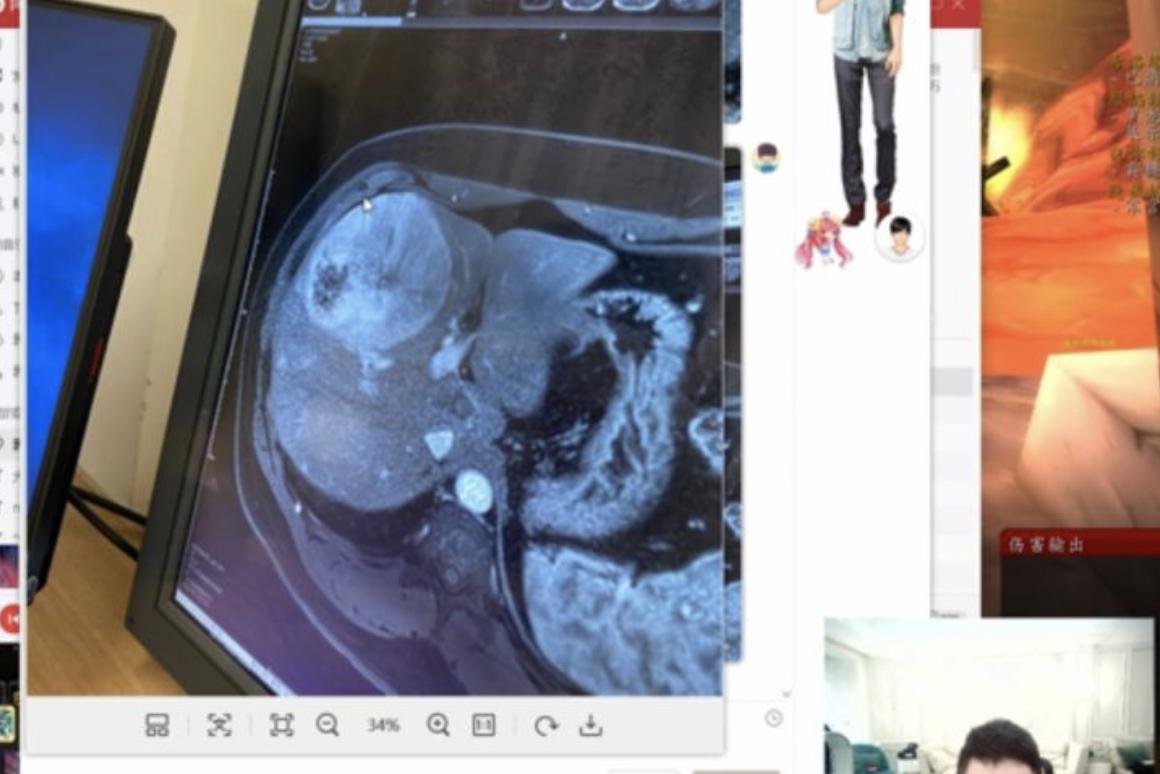 斗鱼一哥pdd宣布停播对你有影响吗,斗鱼回应pdd得什么癌