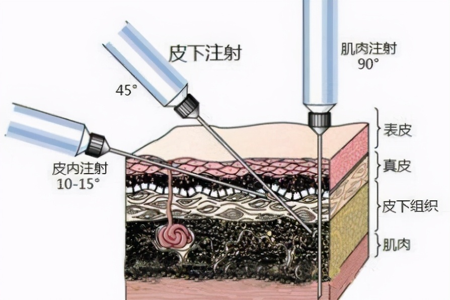 如何给猫打针教程,怎么给猫打针最简单
