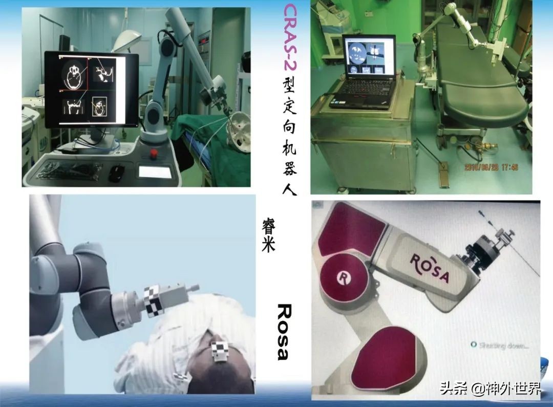 宣武医院神经外科王亚明祖籍,北京宣武医院神经科专家王亚明