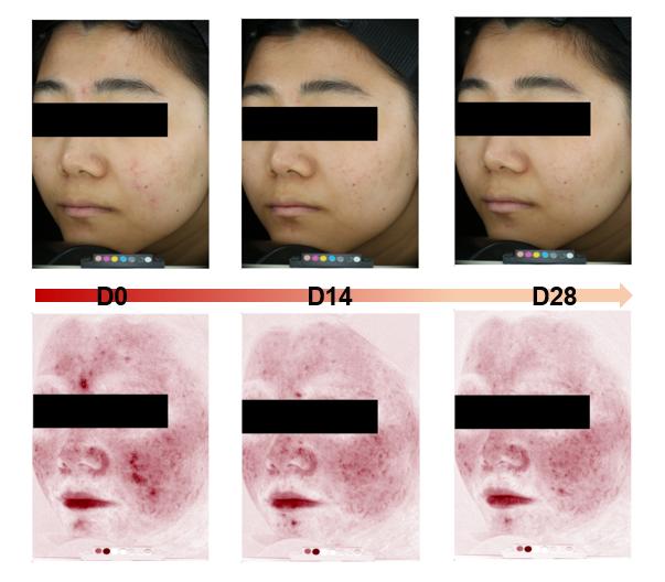 舒缓修护功效,舒缓修护算是功效型吗