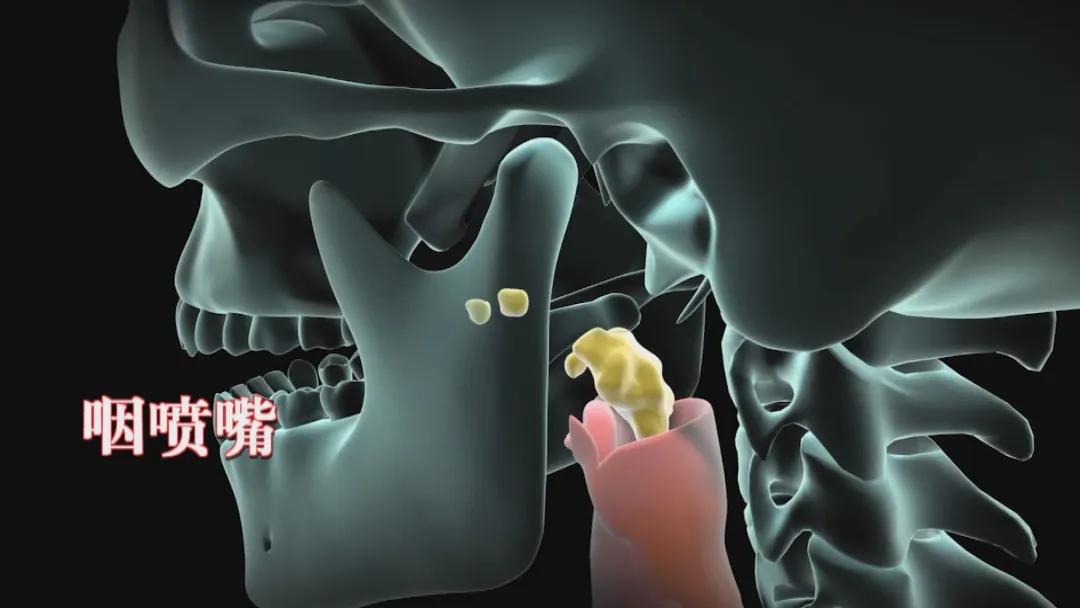 咳嗽胃酸反流喉部痉挛窒息,咳嗽胃食管反流什么症状