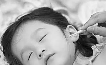 耳屎的颜色一般是什么,耳屎颜色有哪些