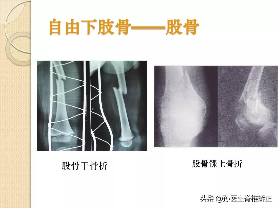 人体解剖学骨骼学思维导图,人体骨骼解剖学纪录片