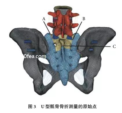 骶骨骨折没内固定能评几级,u型钉67公分单价