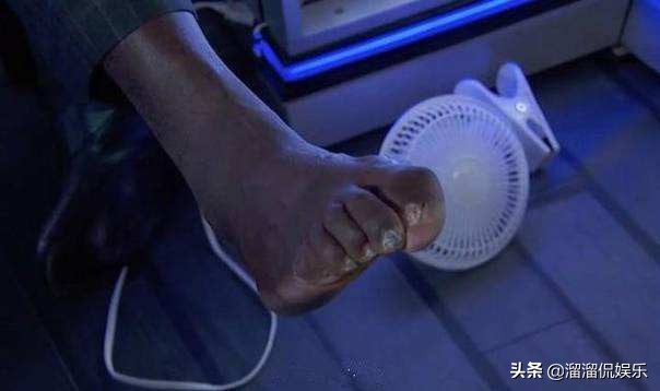 詹姆斯脚趾严重变形图片,詹姆斯脚趾受伤