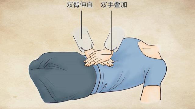 韧带损伤推拿手法,棘上韧带损伤推拿如何治疗