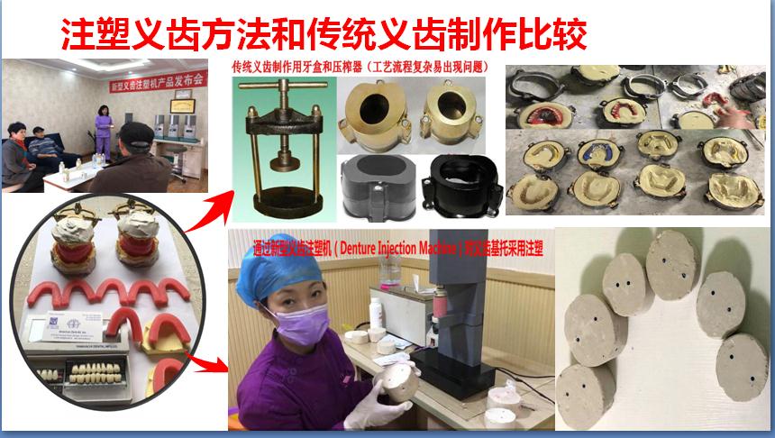 假牙制造技术,制作假牙技术有哪些