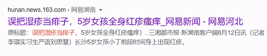 药监局点名！湿疹宝宝霜含禁用成分！这点做不好，再贵的药也没用