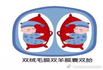 双胎妊娠分娩，顺产行不行？