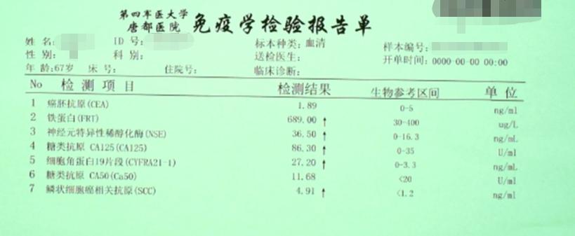 petct肺癌晚期必须要做吗,肺癌患者petct