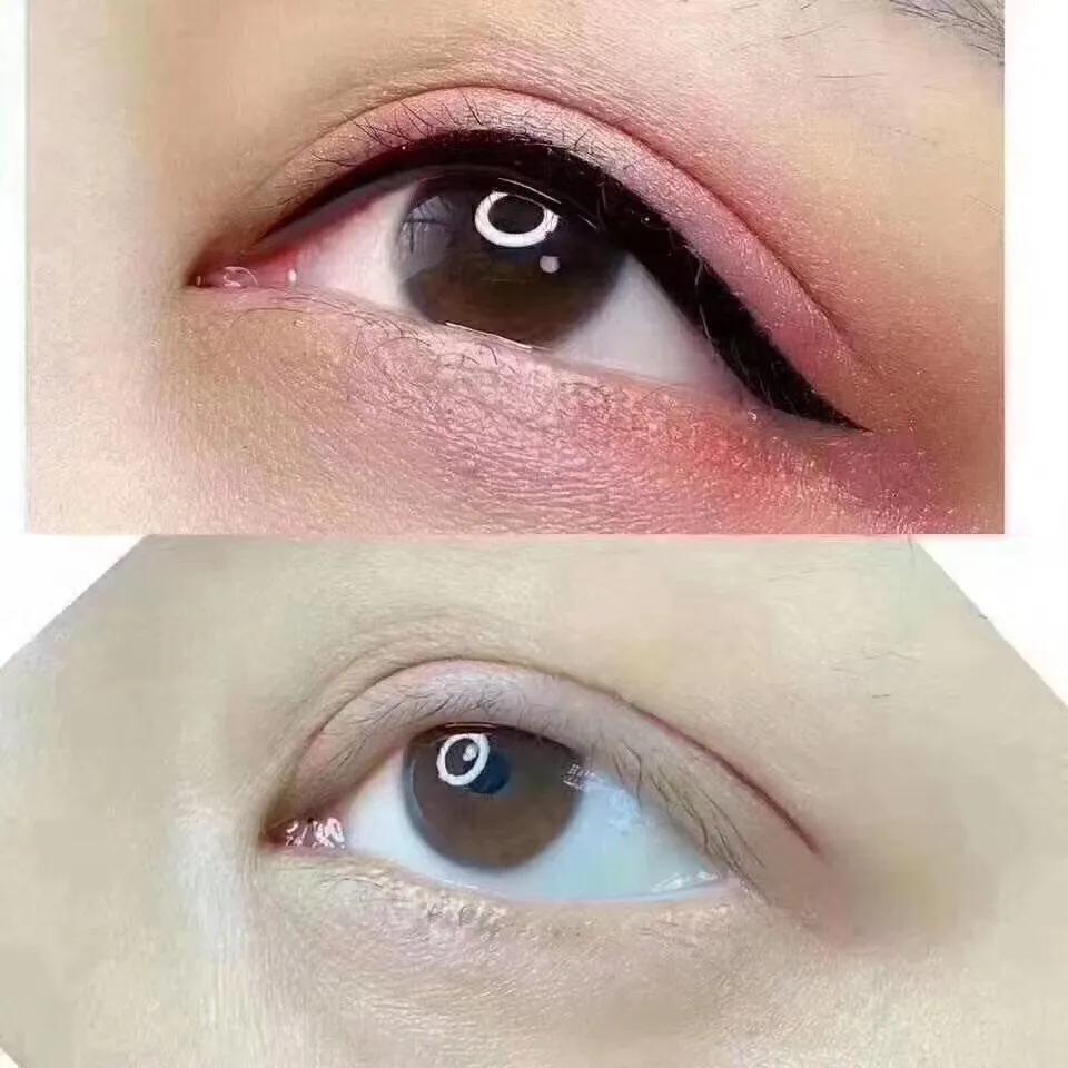 纹眉术后注意事项,八字眉纹眉注意事项