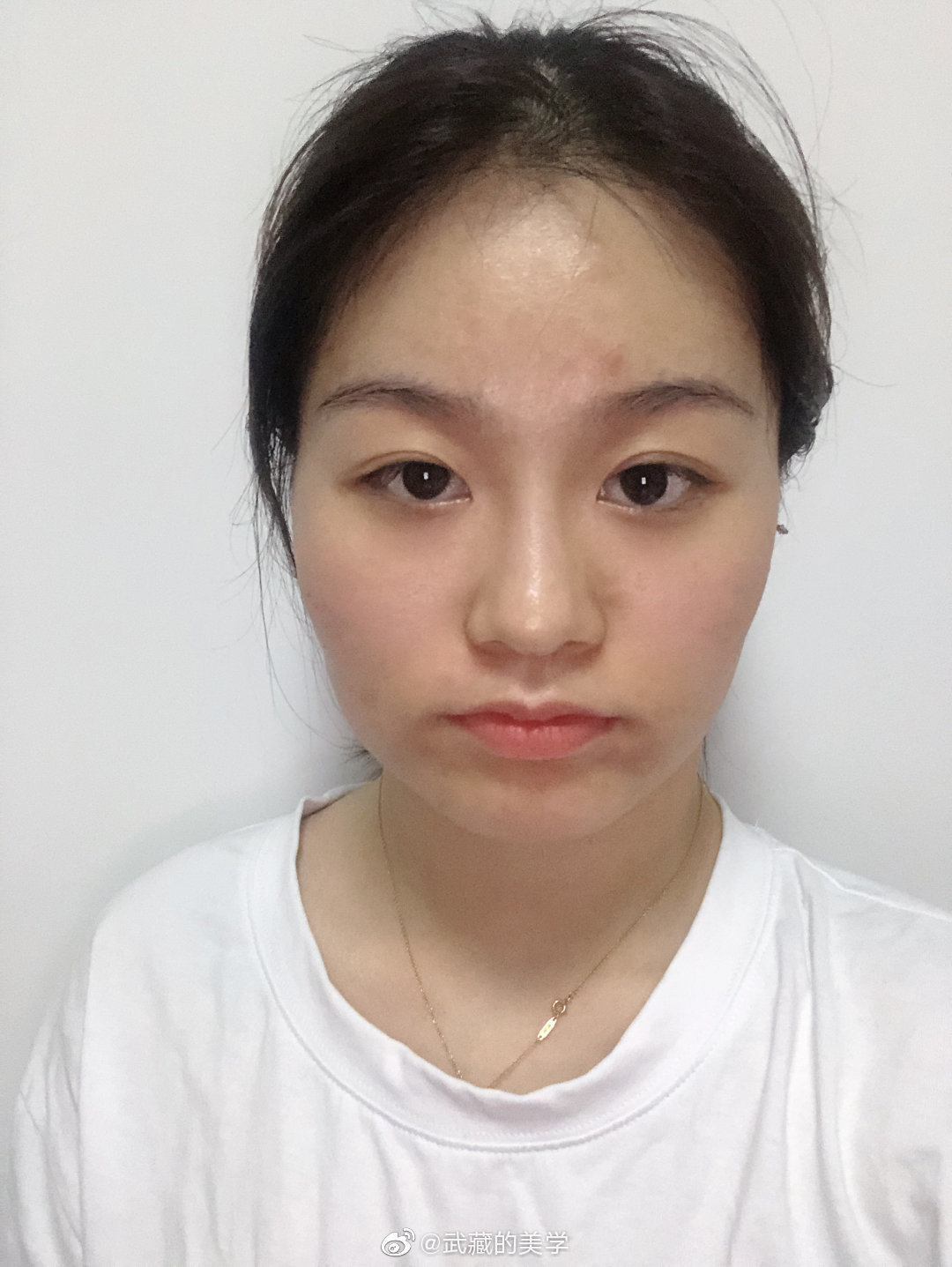 上海首尔丽格鼻子做的怎么样,上海首尔丽格金柱怎么样