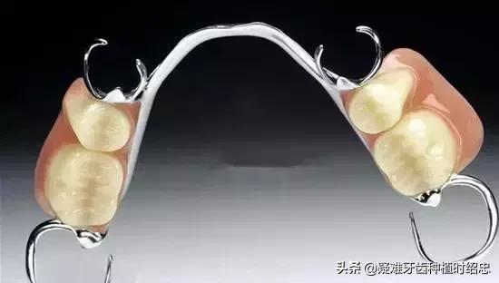 牙周炎牙齿全部掉了好装假牙吗,牙齿掉了安一颗假牙要多少钱