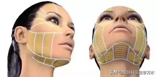 张雨绮说超声刀就像在烤肉？！线雕和超声刀，究竟哪个更靠谱？