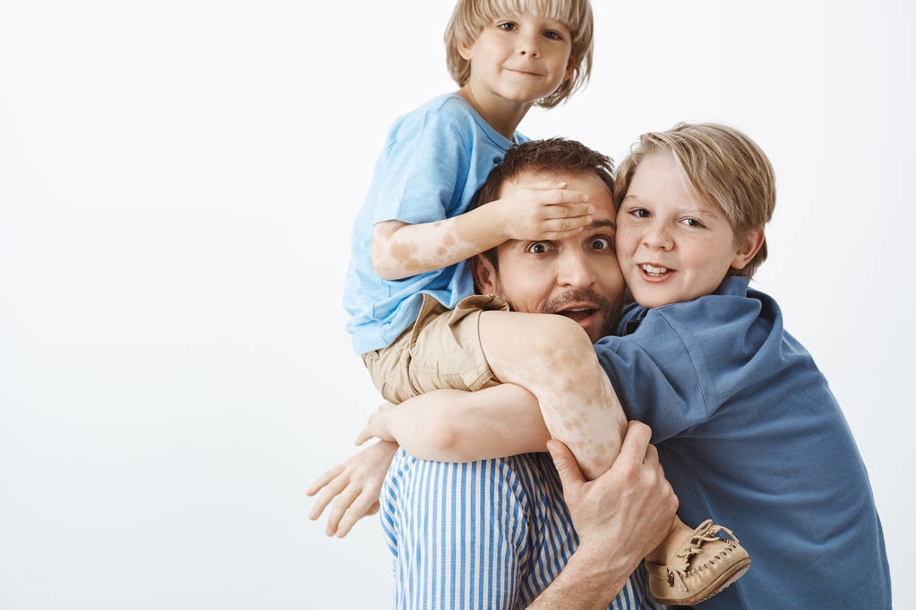 婴幼儿白癜风自愈的最佳方法,患上白癜风不必过于担心