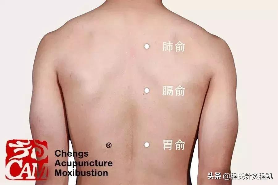 痛经只能默默忍受？中医艾灸调经止痛有奇效