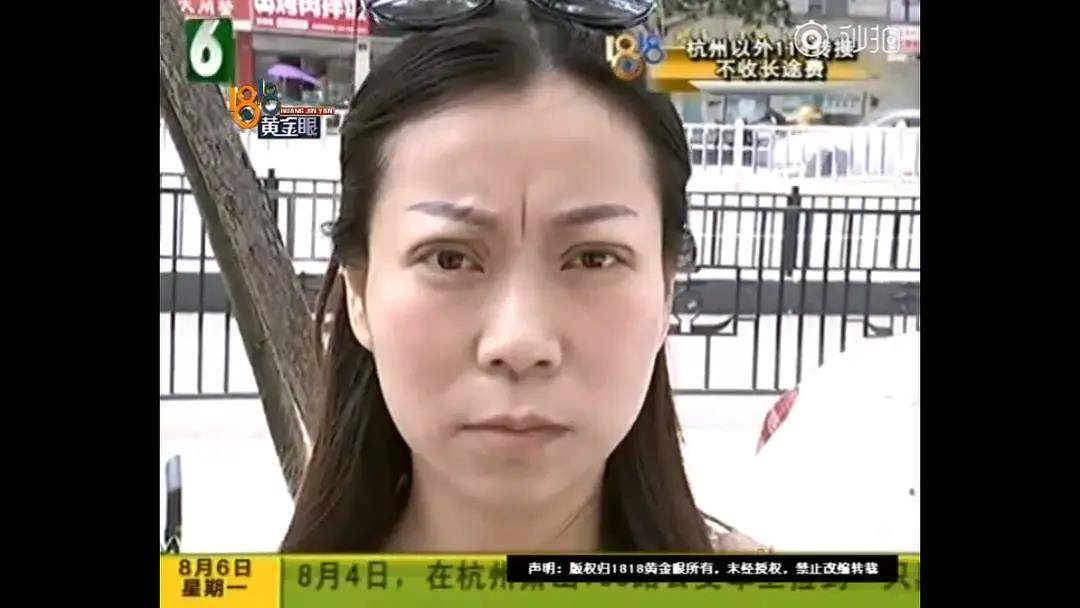 1818黄金眼杭州姑娘整容,1818黄金眼整容成功案例