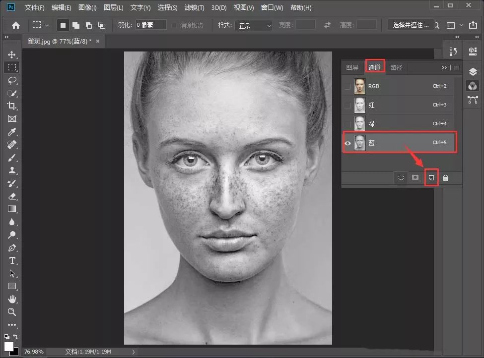 祛除脸部雀斑最有效的方法,有什么日常方法可以去除脸上雀斑