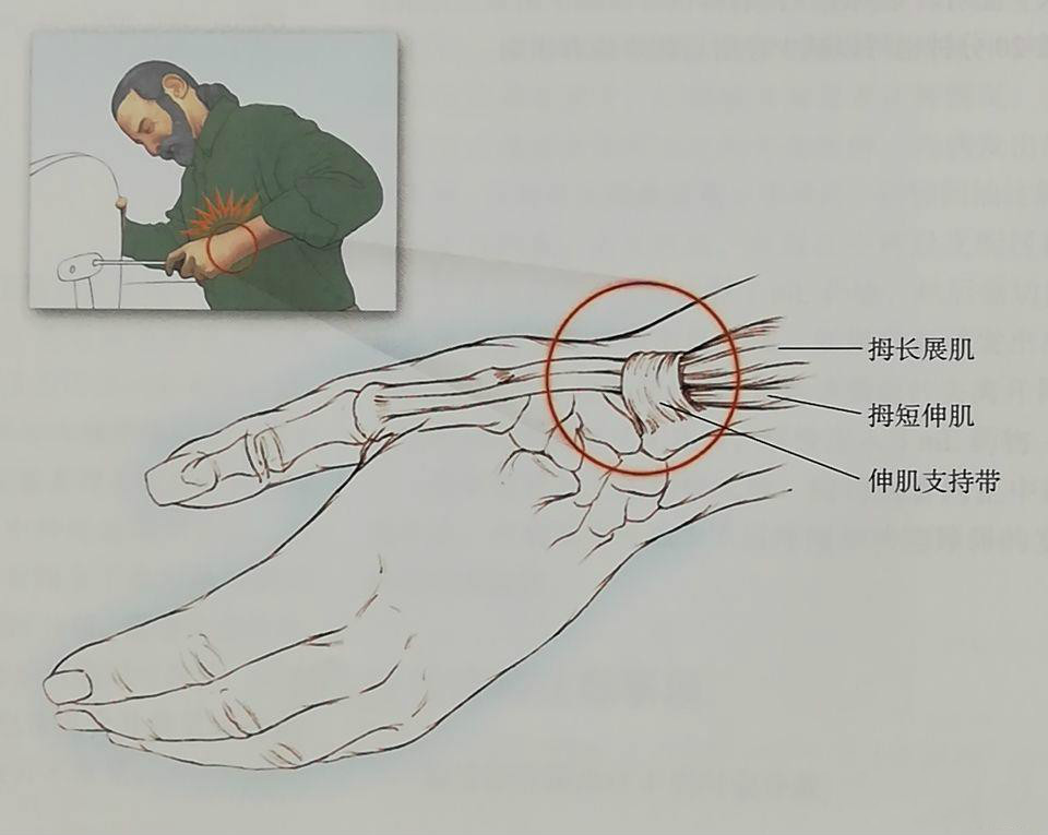 健身如何保养腕关节,健身怎么保护肘关节