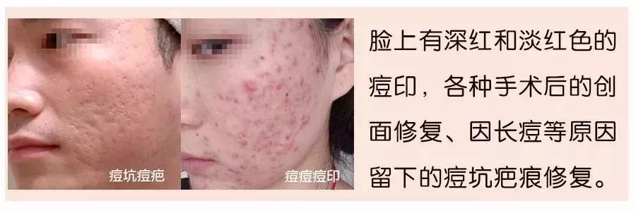 干粉冷冻,冷冻干粉的作用和功效