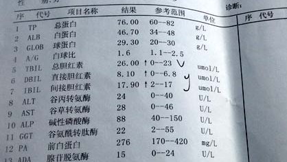 胆红素高，是什么原因，有危害吗？吃什么药能降？听听医生怎么说