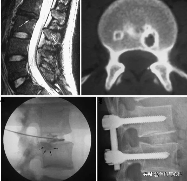 腰痛要警惕四种原因肾不好,盘点腰痛常见病因及防治训练