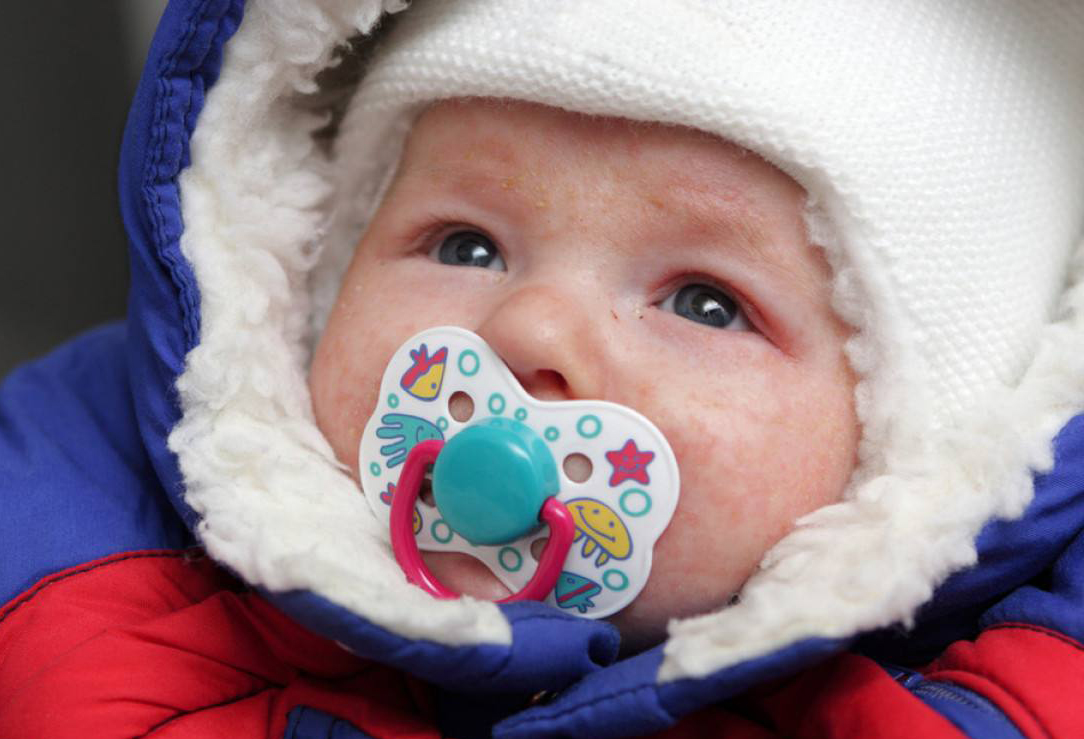 手上起湿疹是因为什么原因,身上起湿疹是什么原因引起的