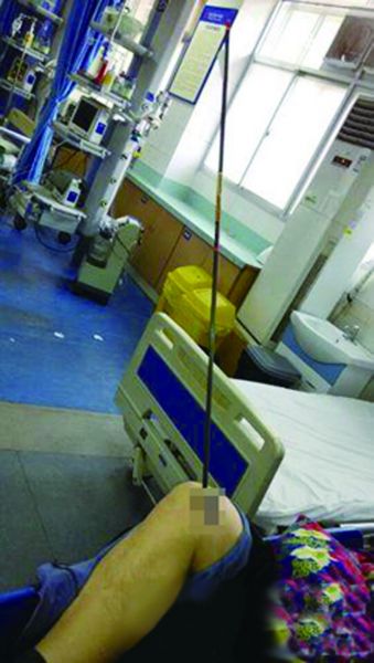 中箭的威力有多大,古代的弓箭能把人射死吗