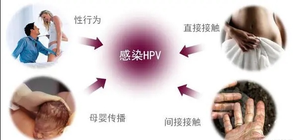 HPV反复发作不见好可能是宫颈癌?预防HPV有捷径,这些功课需做全