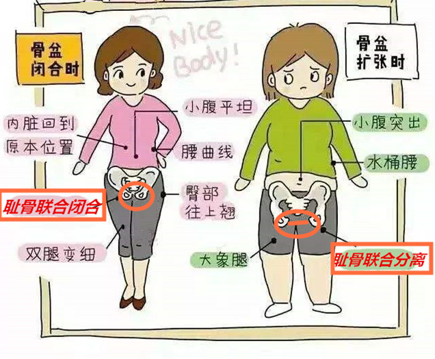 产后屁股大胯宽凹陷下垂怎么恢复,产后屁股又扁又大该怎么办