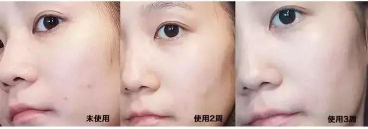 王鸥推荐的精华水,欧阳娜娜推荐的乳霜