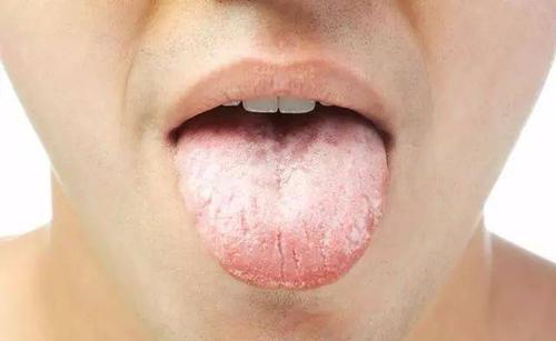 脾虚气血虚先治脾还是血,中药补气血要调理多久脾胃虚