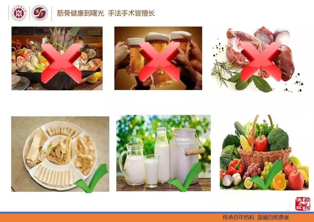 痛风及高尿酸血症患者的生活指导