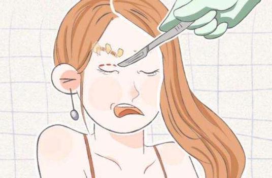 做了双眼皮肉条感太明显怎么修复,双眼皮肉条感明显怎么做