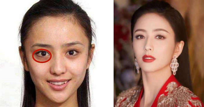 女子为变美花掉300余万后续,女子为变美脸塌陷