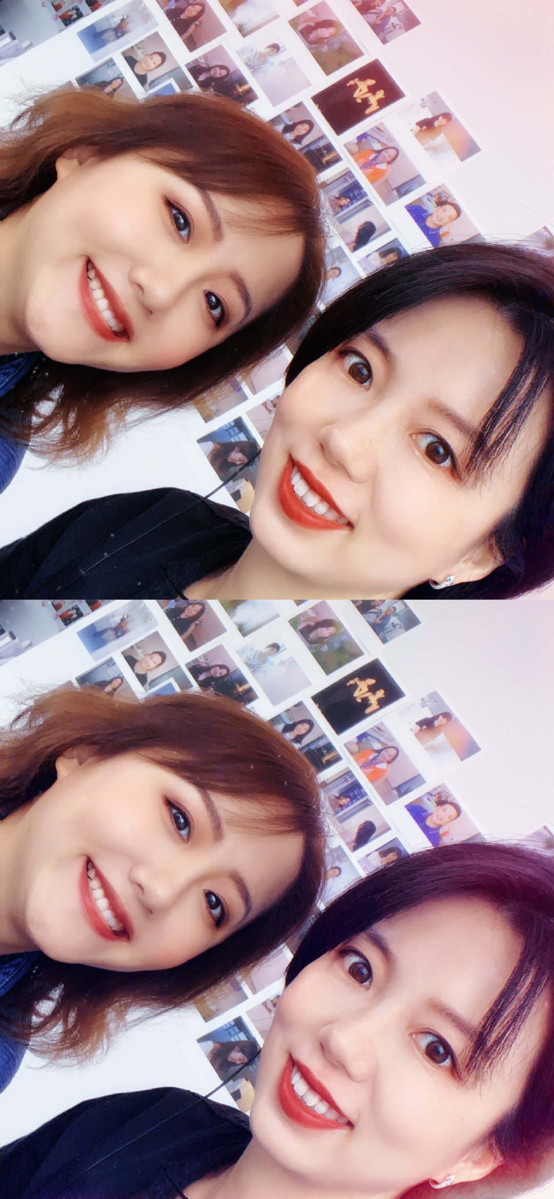 正畸医生邰怡的作品,南京牙齿矫正邰医生