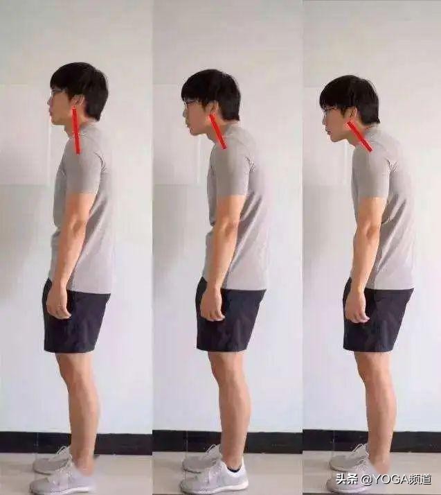 专治腰椎颈椎疼痛健身操,颈椎腰椎关节疼痛吃什么药