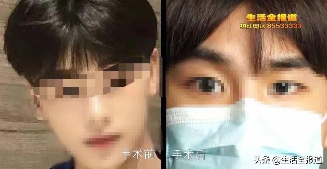 整容医院到底有多少套路？网红帅小伙在武汉一家医美整容“出事了”
