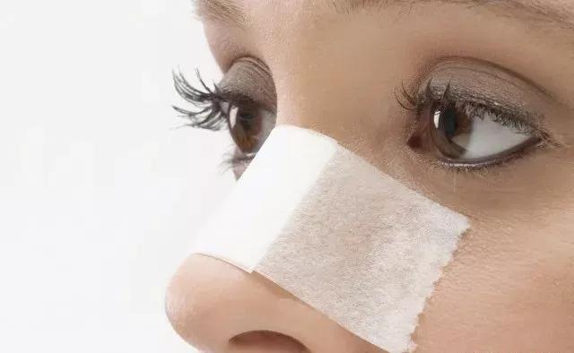 名门泽佳怎么祛除痘印,名门泽佳祛痘效果怎么样