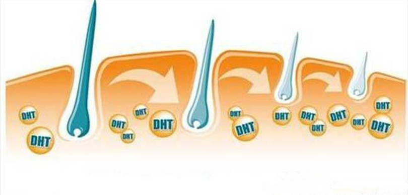 头发为什么越来越细软如何改善,为什么会有特别细软的头发