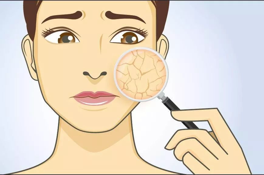 冬季干燥寒冷怎么护肤,干燥寒冷怎么保湿