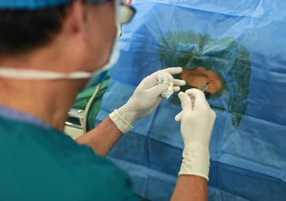 顺产侧切会影响下次顺产吗,顺产侧切对身体有什么危害