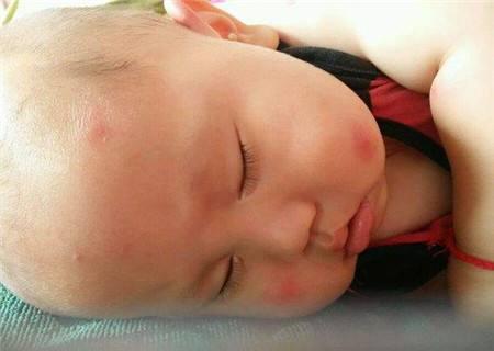 蚊香怎么消灭蚊子最好方法,乡下蚊子多有何妙招