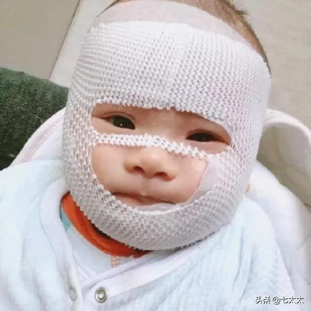 以「湿疹」之名的智商税，除了「大头娃娃」还有什么？