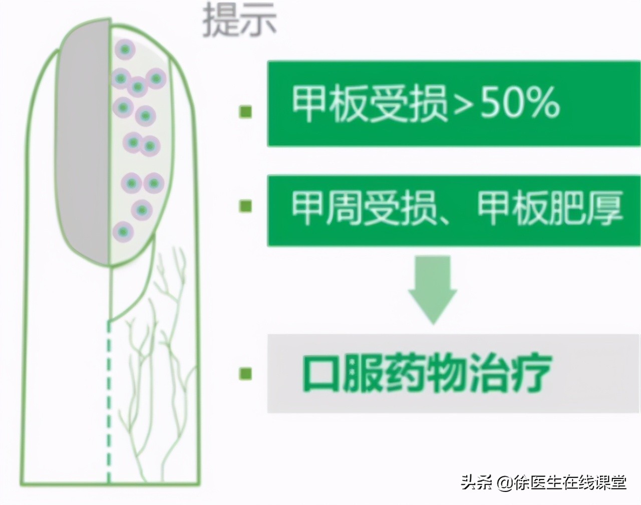 得了灰指甲用什么办法能治好,灰指甲怎么治好得最快小妙招
