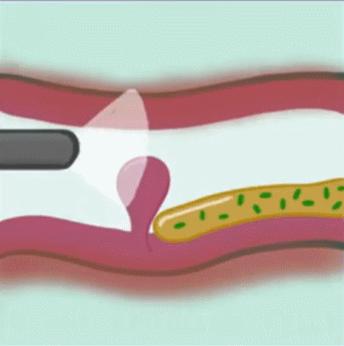 老鼻炎怎么治,老人长期鼻炎需要注意什么