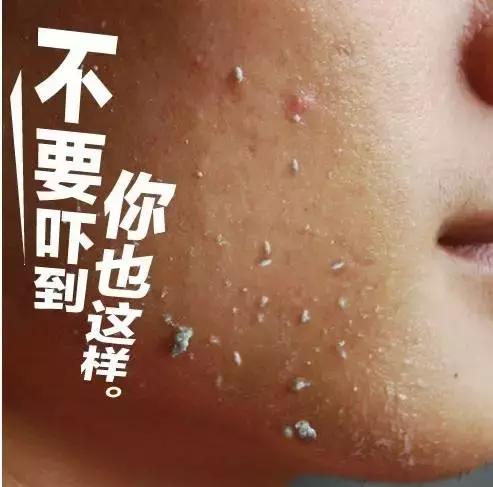 做水疗的功效与作用,水疗有什么